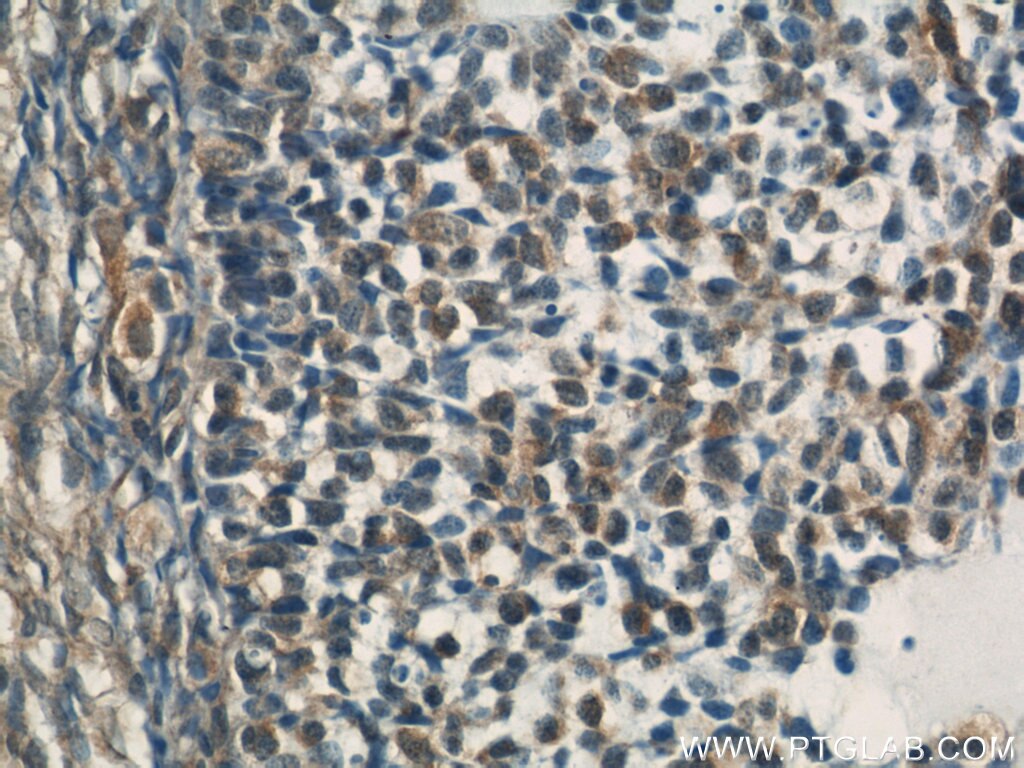 Immunohistochemistry (IHC) staining of human ovary tissue using RYK Polyclonal antibody (22138-1-AP)