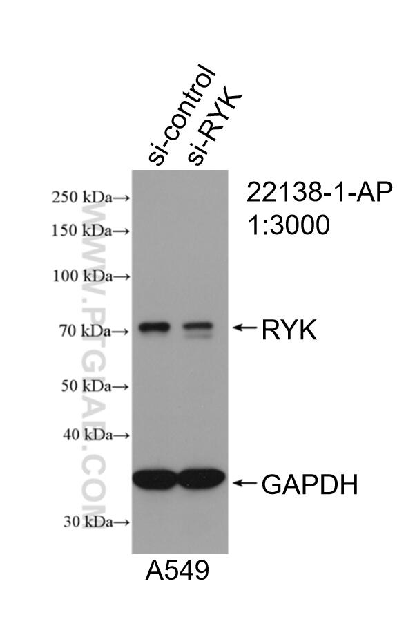 Western Blot (WB) analysis of A549 cells using RYK Polyclonal antibody (22138-1-AP)