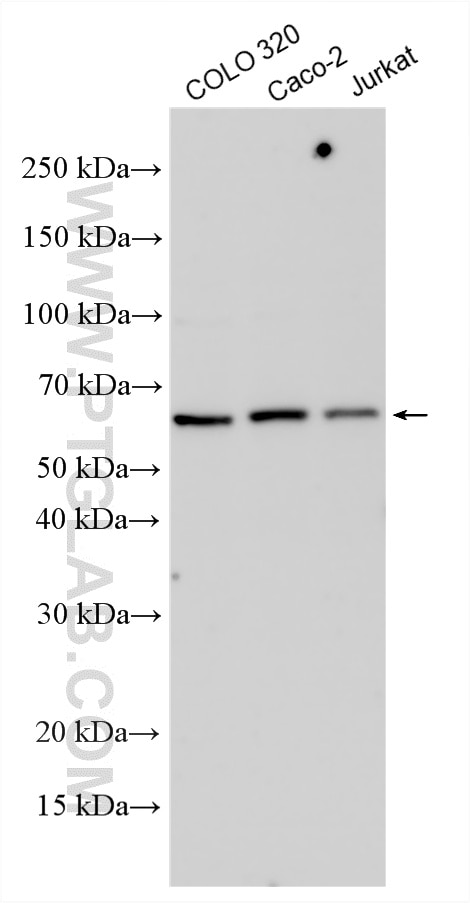 Western Blot (WB) analysis of various lysates using RYK Polyclonal antibody (22138-1-AP)
