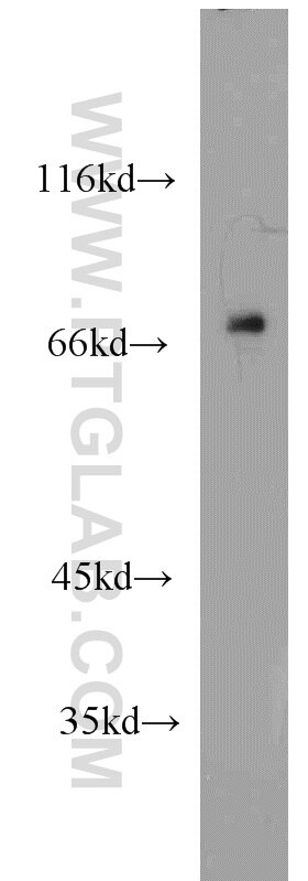 Western Blot (WB) analysis of mouse brain tissue using RYK Polyclonal antibody (22138-1-AP)