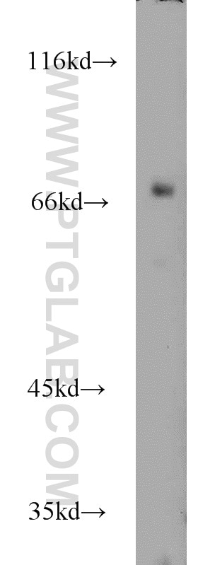 Western Blot (WB) analysis of SH-SY5Y cells using RYK Polyclonal antibody (22138-1-AP)