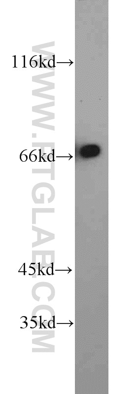 Western Blot (WB) analysis of Jurkat cells using RYK Polyclonal antibody (22138-1-AP)