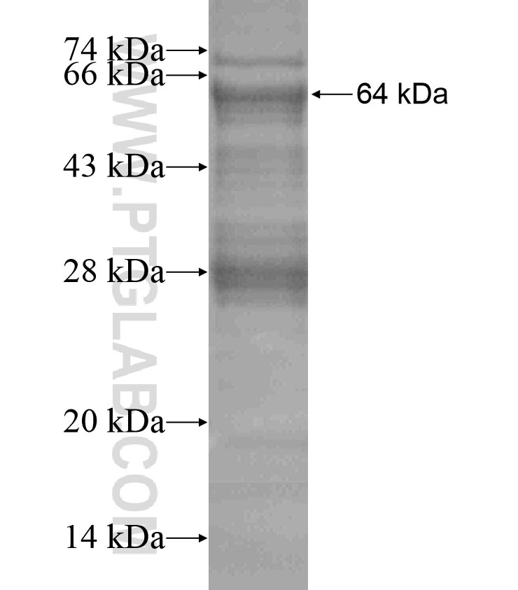 RYK fusion protein Ag17540 SDS-PAGE