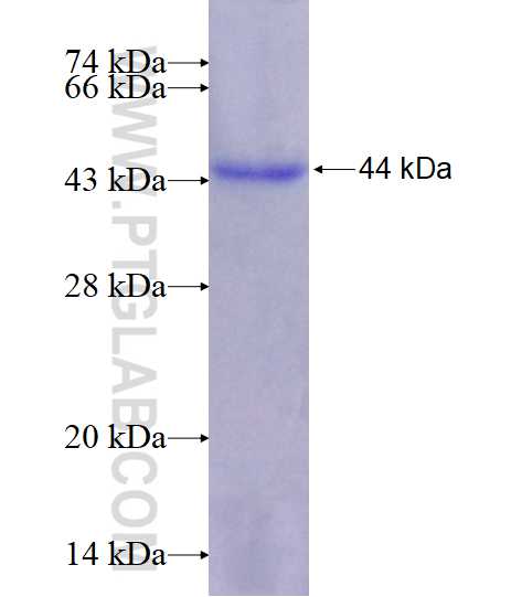RYK fusion protein Ag17669 SDS-PAGE