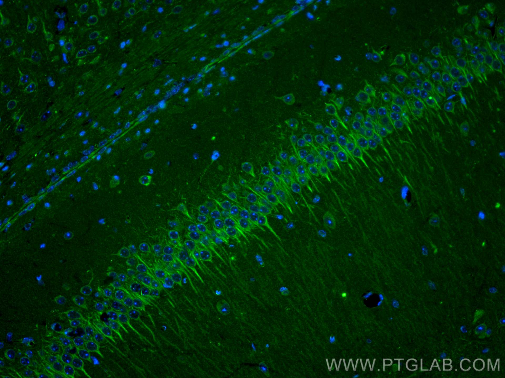 Immunofluorescence (IF) / fluorescent staining of mouse brain tissue using RYR1 Polyclonal antibody (26968-1-AP)