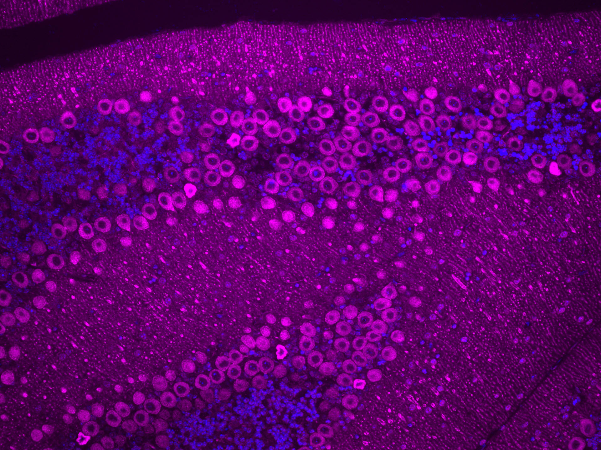 Immunofluorescence (IF) / fluorescent staining of mouse cerebellum tissue using RYR1 Polyclonal antibody (26968-1-AP)