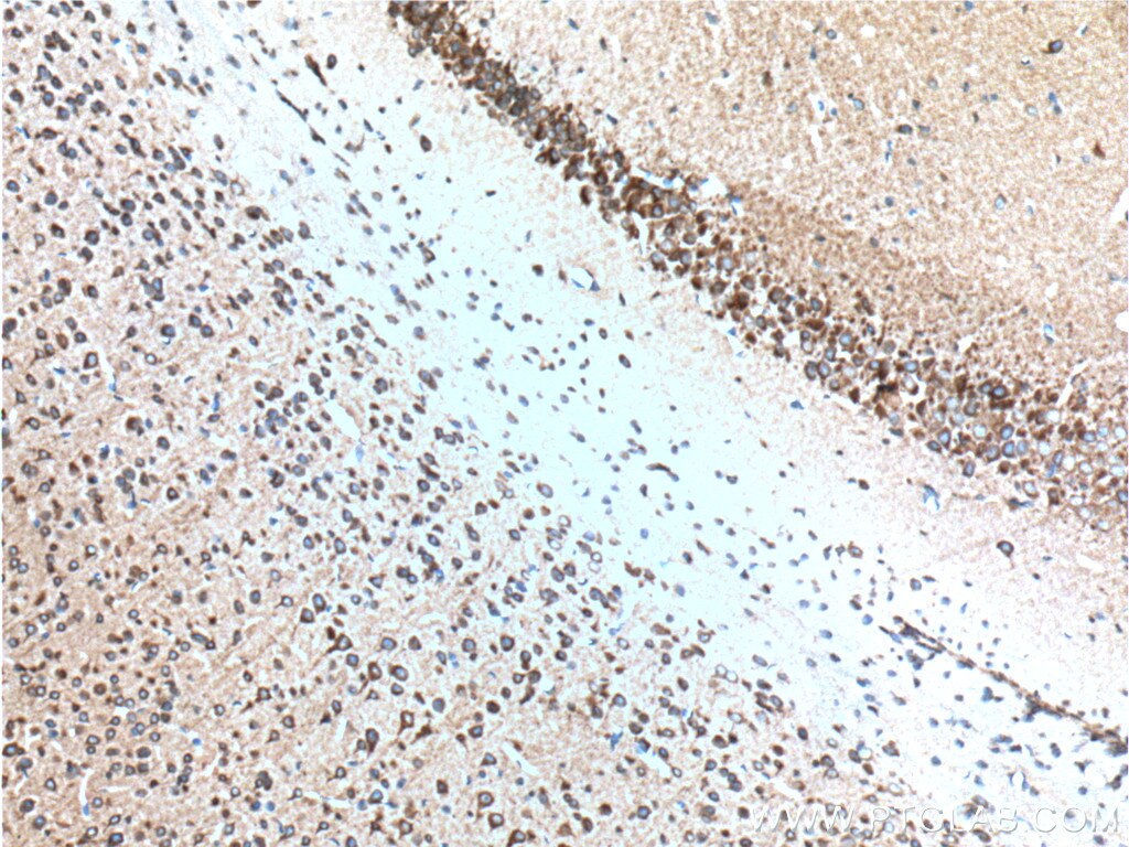 Immunohistochemistry (IHC) staining of mouse brain tissue using RYR1 Polyclonal antibody (26968-1-AP)