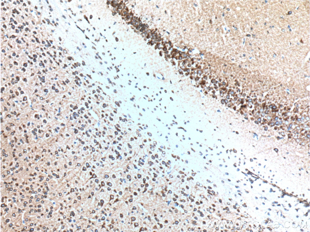 Immunohistochemistry (IHC) staining of mouse brain tissue using RYR1 Polyclonal antibody (26968-1-AP)