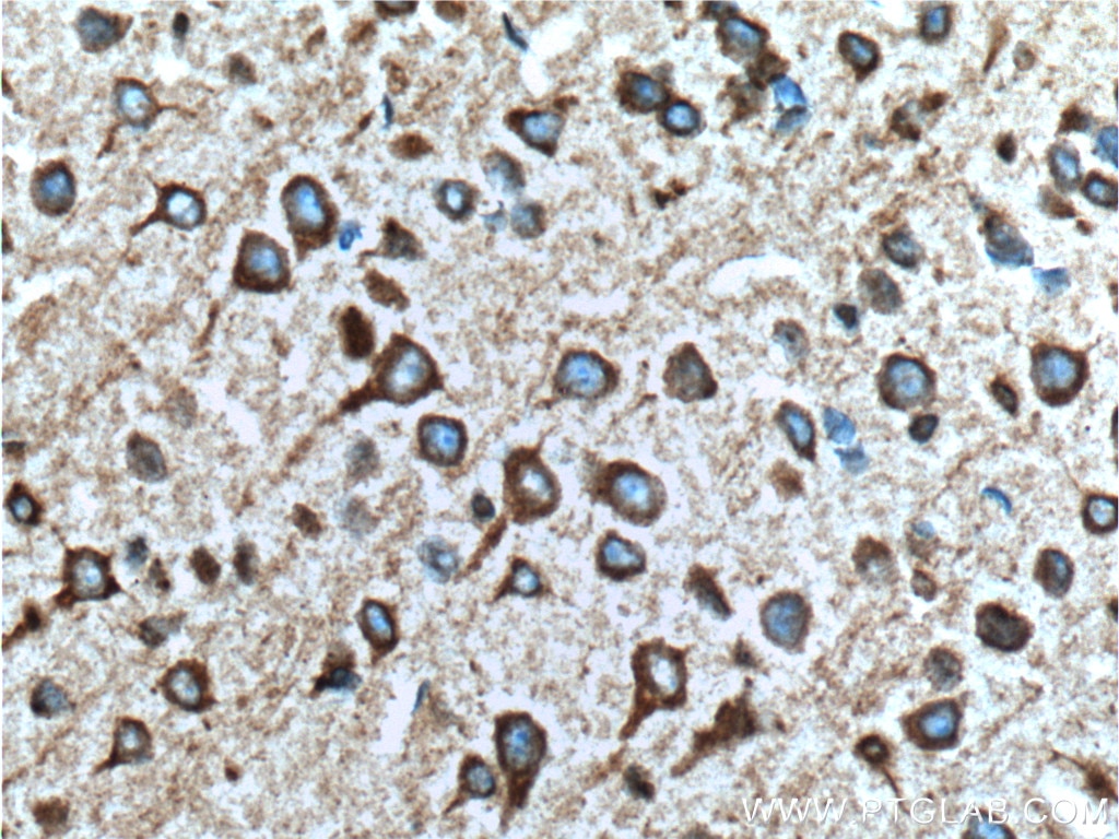 Immunohistochemistry (IHC) staining of mouse brain tissue using RYR1 Polyclonal antibody (26968-1-AP)