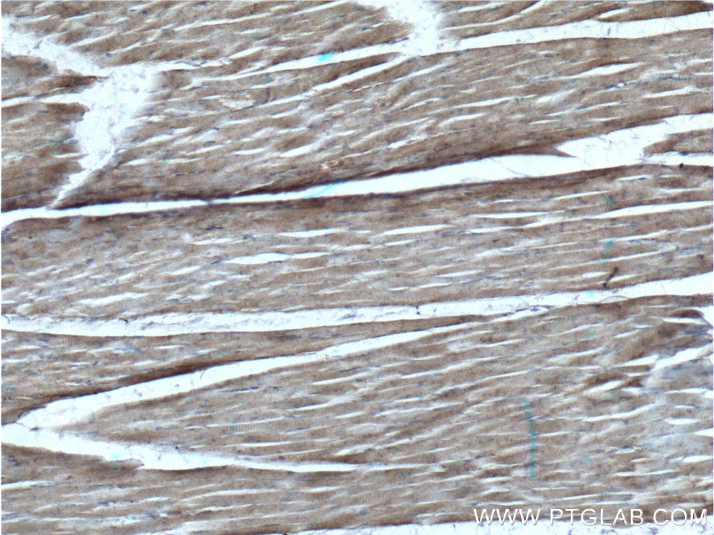 IHC staining of human skeletal muscle using 26968-1-AP