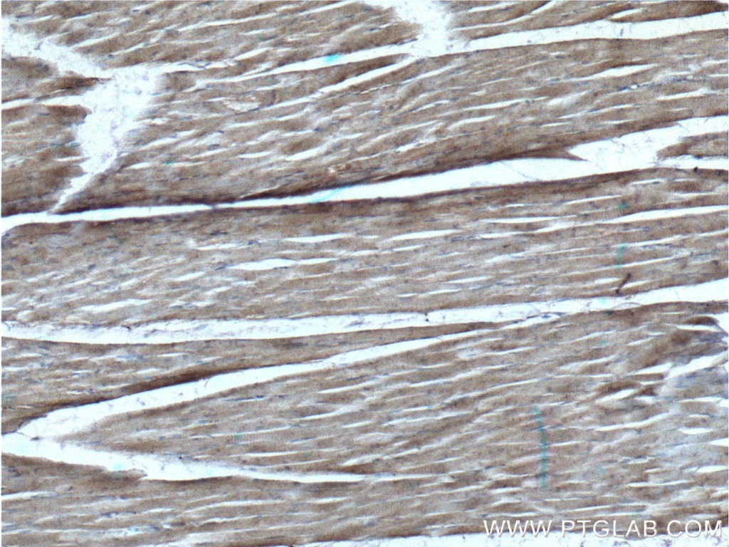 Immunohistochemistry (IHC) staining of human skeletal muscle tissue using RYR1 Polyclonal antibody (26968-1-AP)