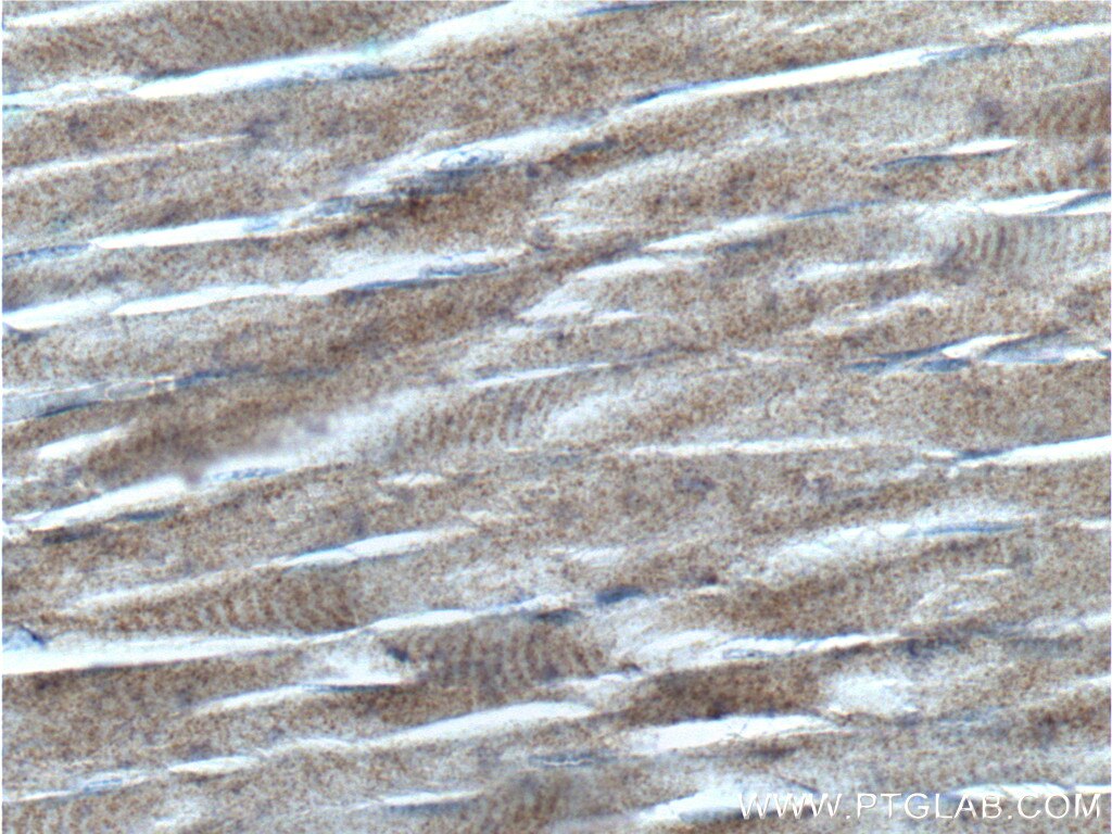 Immunohistochemistry (IHC) staining of human skeletal muscle tissue using RYR1 Polyclonal antibody (26968-1-AP)