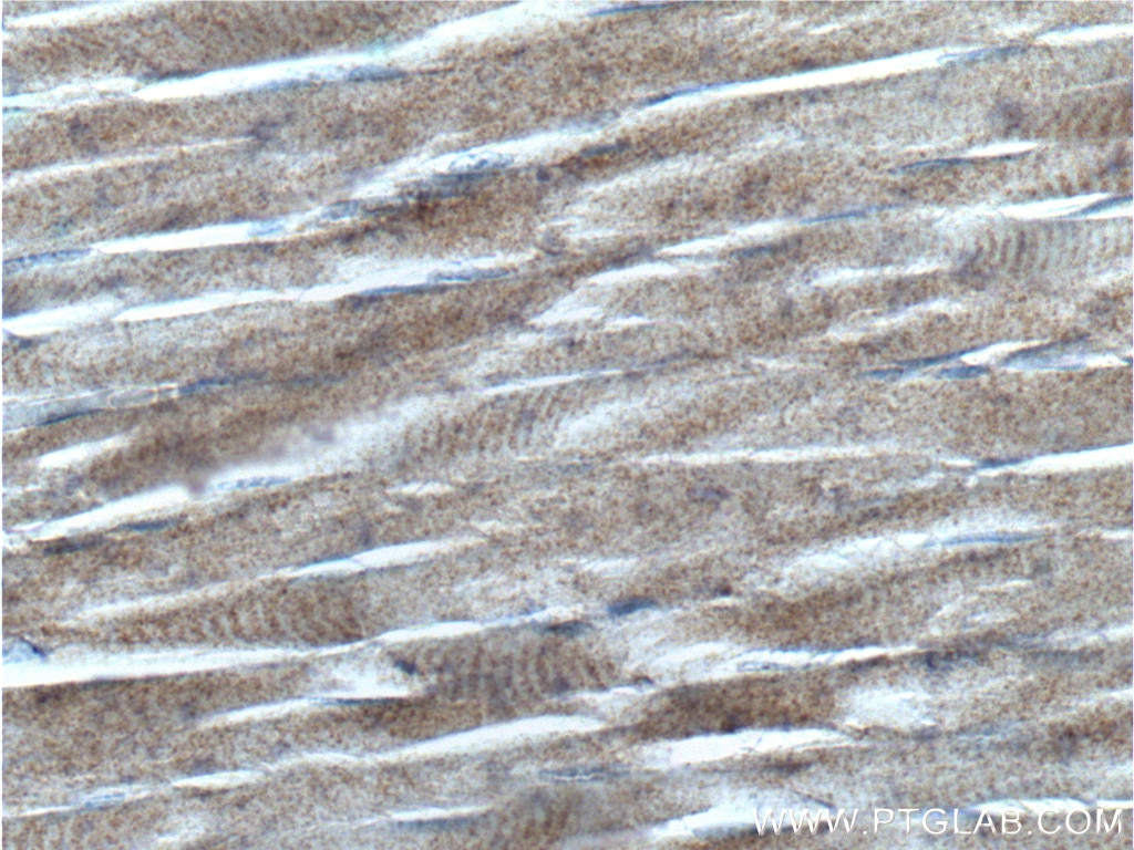 IHC staining of human skeletal muscle using 26968-1-AP