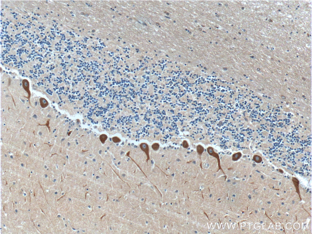 Immunohistochemistry (IHC) staining of human cerebellum tissue using RYR1 Polyclonal antibody (26968-1-AP)