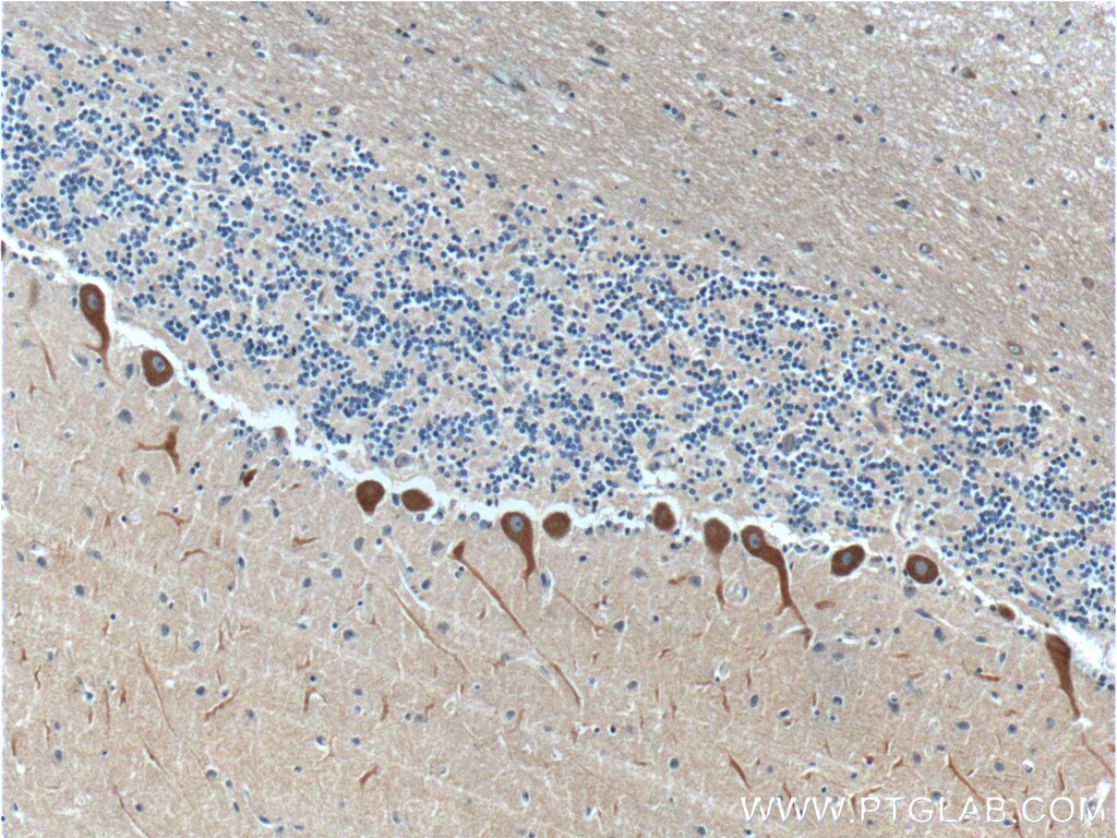 Immunohistochemistry (IHC) staining of human cerebellum tissue using RYR1 Polyclonal antibody (26968-1-AP)