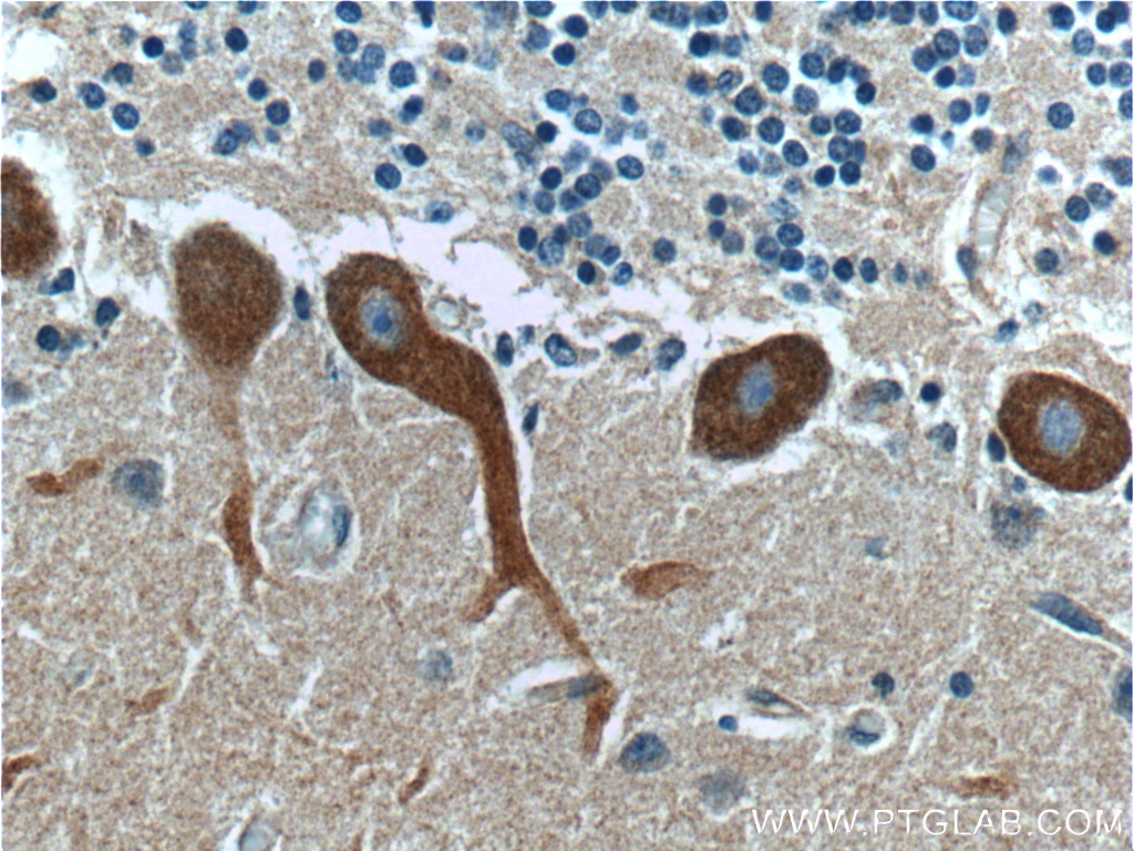 Immunohistochemistry (IHC) staining of human cerebellum tissue using RYR1 Polyclonal antibody (26968-1-AP)