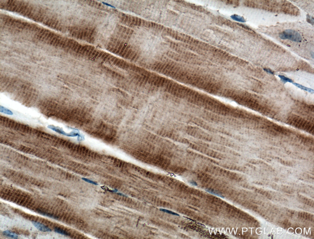 Immunohistochemistry (IHC) staining of mouse skeletal muscle tissue using RYR1 Monoclonal antibody (66539-1-Ig)