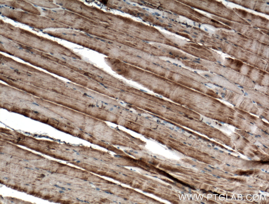 Immunohistochemistry (IHC) staining of mouse skeletal muscle tissue using RYR1 Monoclonal antibody (66539-1-Ig)