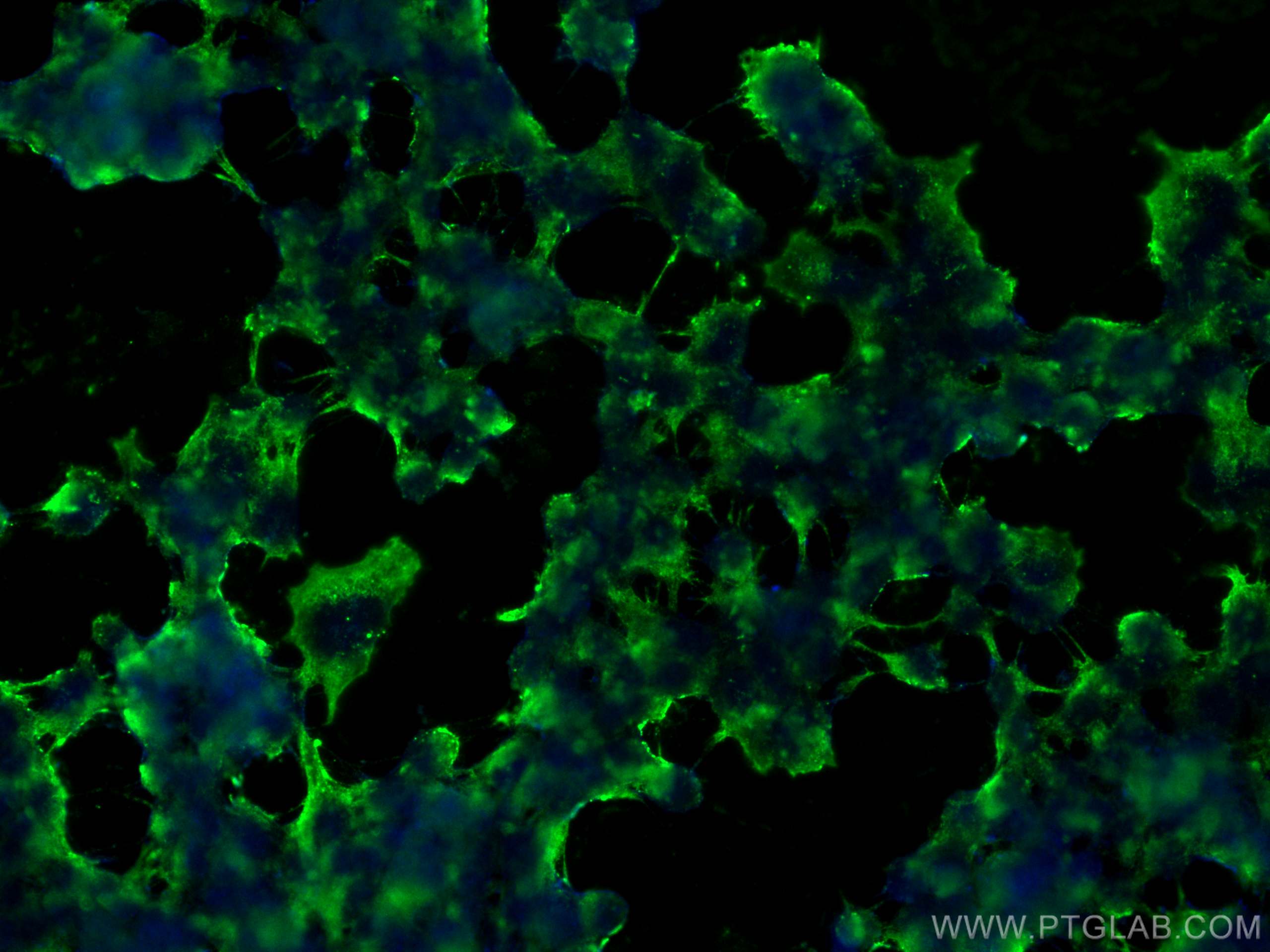 Immunofluorescence (IF) / fluorescent staining of PC-12 cells using CoraLite® Plus 488-conjugated RYR1 Monoclonal anti (CL488-66539)