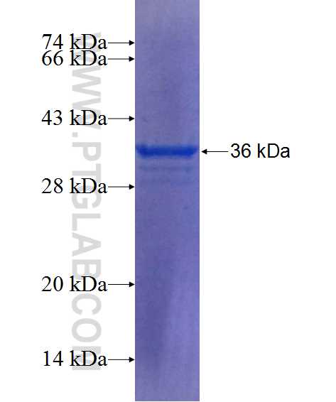 RYR1 fusion protein Ag25120 SDS-PAGE