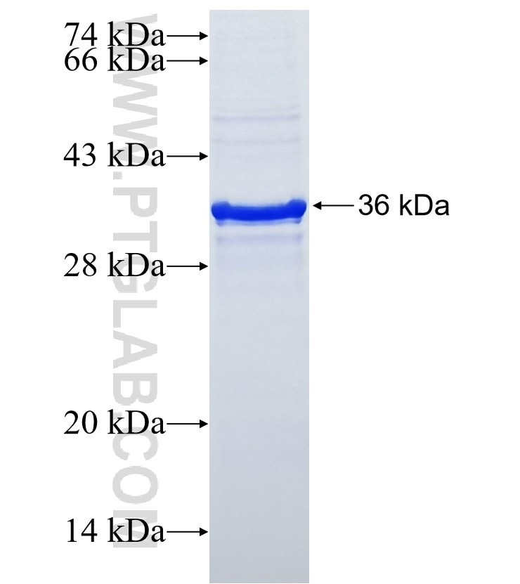 RYR1 fusion protein Ag25120 SDS-PAGE