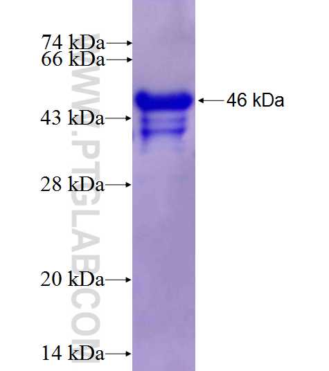 RYR1 fusion protein Ag26985 SDS-PAGE