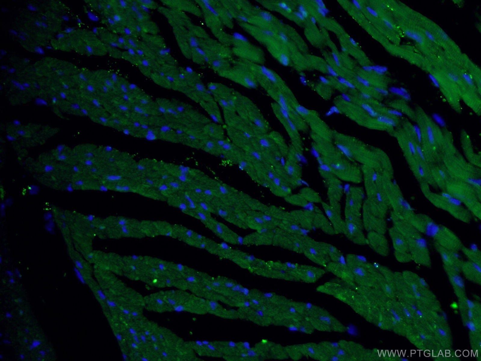 Immunofluorescence (IF) / fluorescent staining of mouse heart tissue using RYR2 Polyclonal antibody (19765-1-AP)