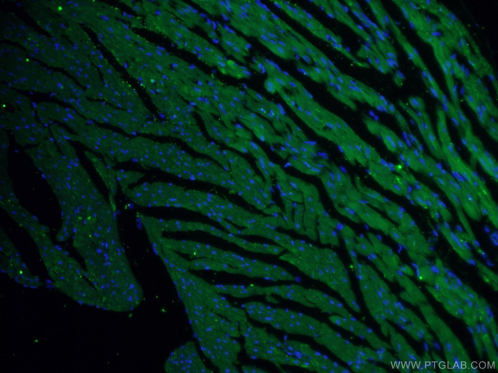 IF Staining of mouse heart using 19765-1-AP