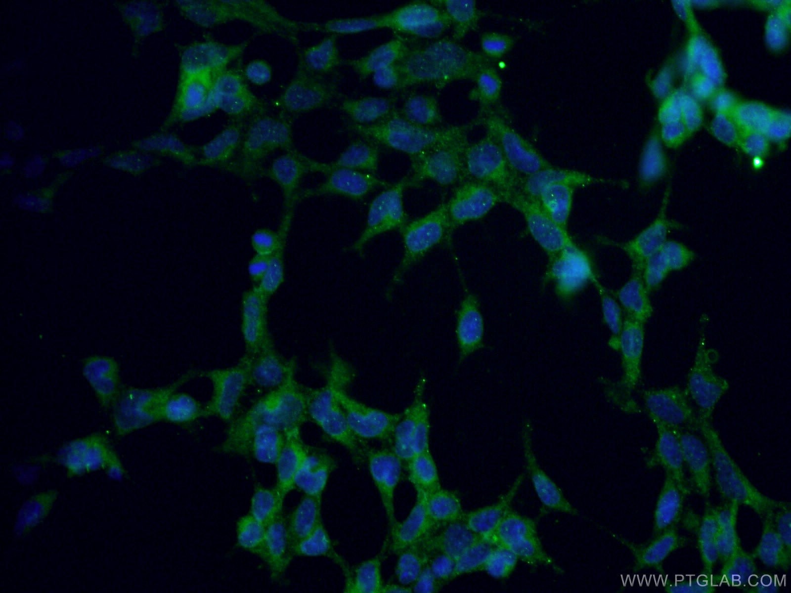 Immunofluorescence (IF) / fluorescent staining of HEK-293 cells using RYR2 Polyclonal antibody (19765-1-AP)