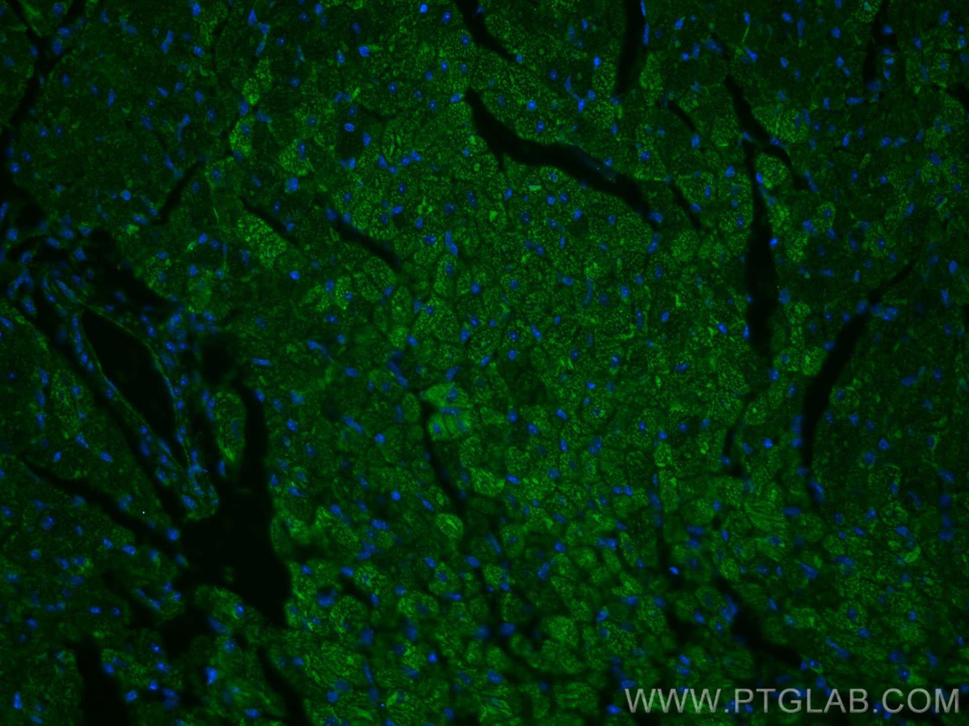 Immunofluorescence (IF) / fluorescent staining of mouse heart tissue using RYR2 Polyclonal antibody (19765-1-AP)