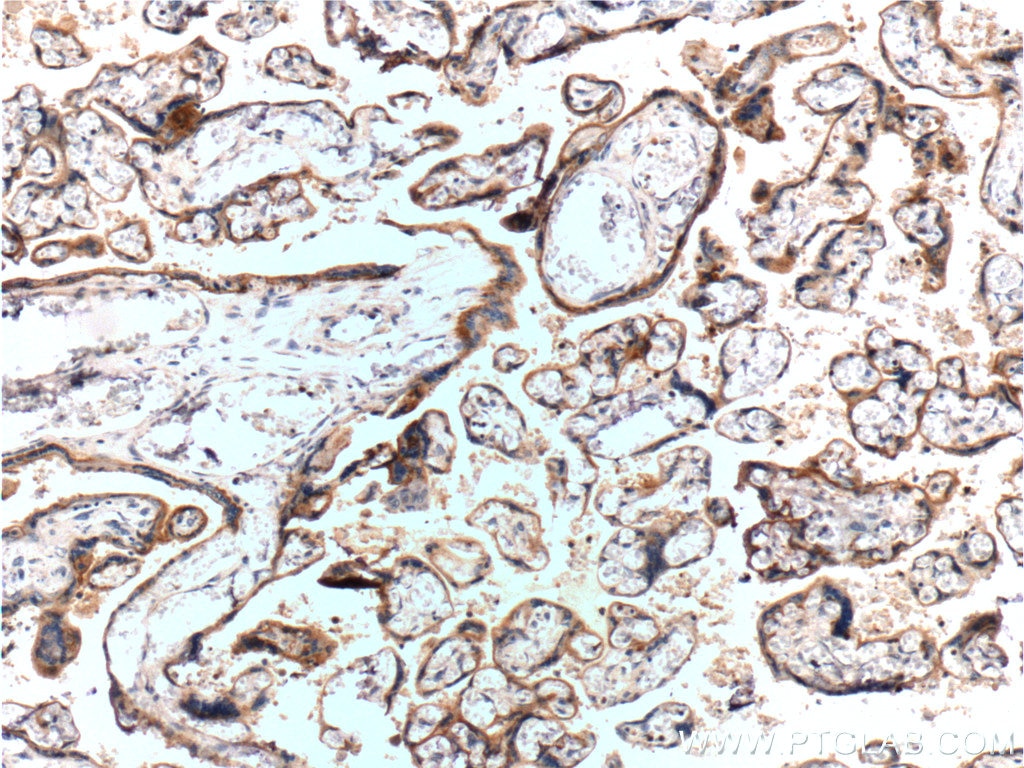 Immunohistochemistry (IHC) staining of human placenta tissue using RYR2 Polyclonal antibody (19765-1-AP)