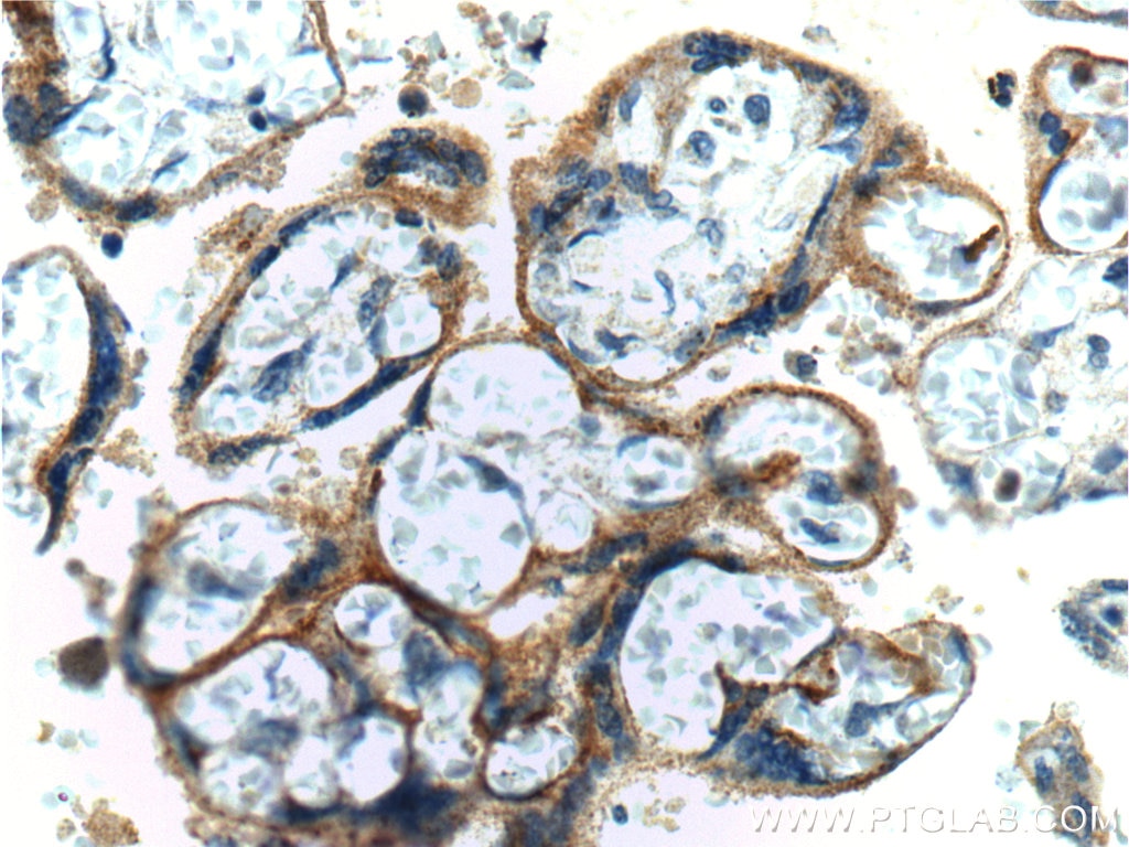 IHC staining of human placenta using 19765-1-AP