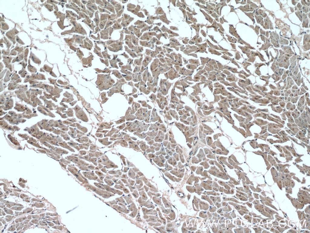 Immunohistochemistry (IHC) staining of human heart tissue using RYR2 Polyclonal antibody (19765-1-AP)