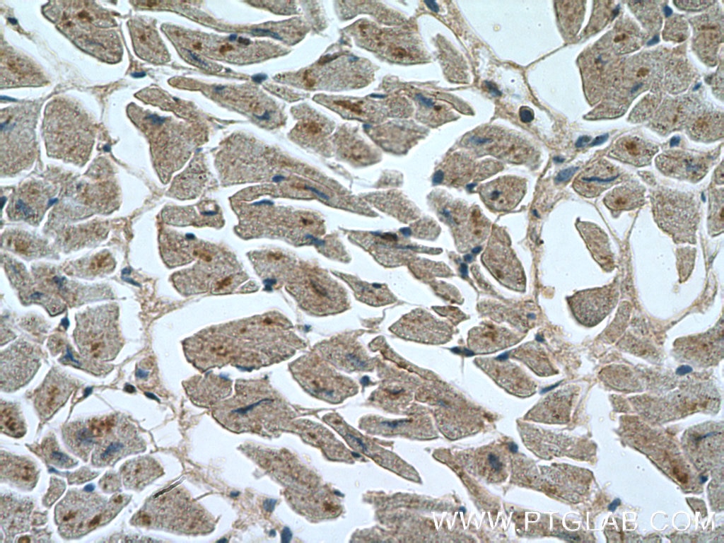 Immunohistochemistry (IHC) staining of human heart tissue using RYR2 Polyclonal antibody (19765-1-AP)