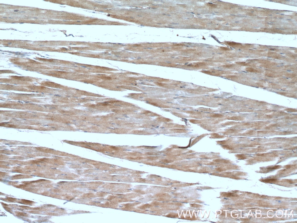 Immunohistochemistry (IHC) staining of human skeletal muscle tissue using RYR2 Polyclonal antibody (19765-1-AP)