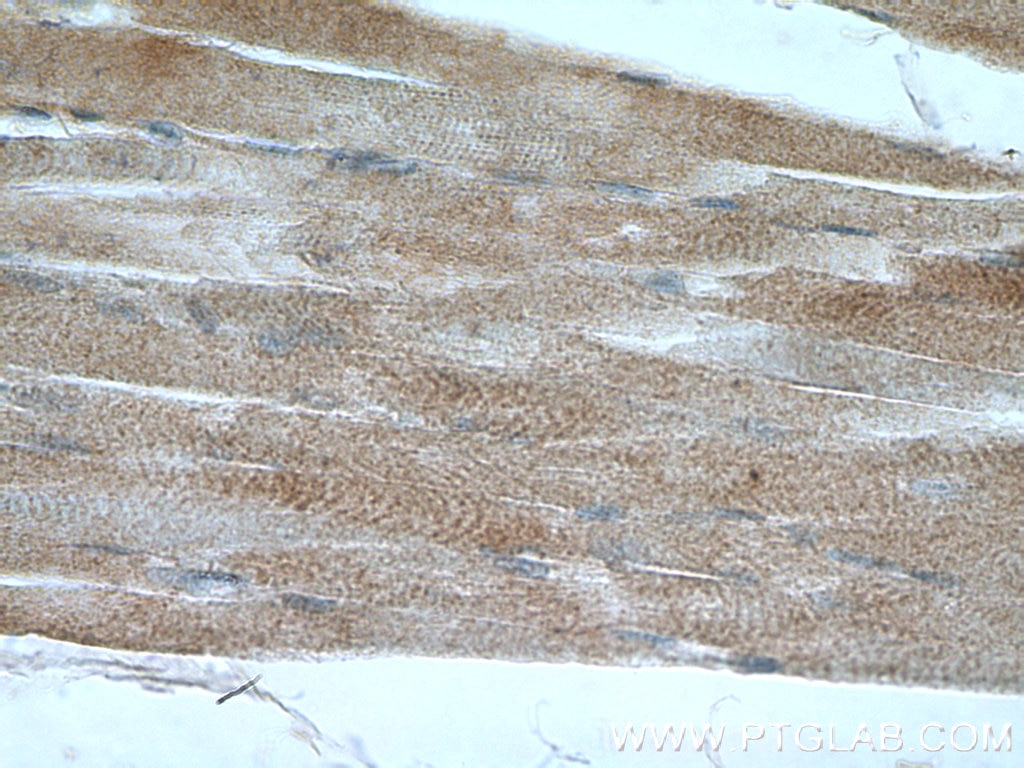 Immunohistochemistry (IHC) staining of human skeletal muscle tissue using RYR2 Polyclonal antibody (19765-1-AP)