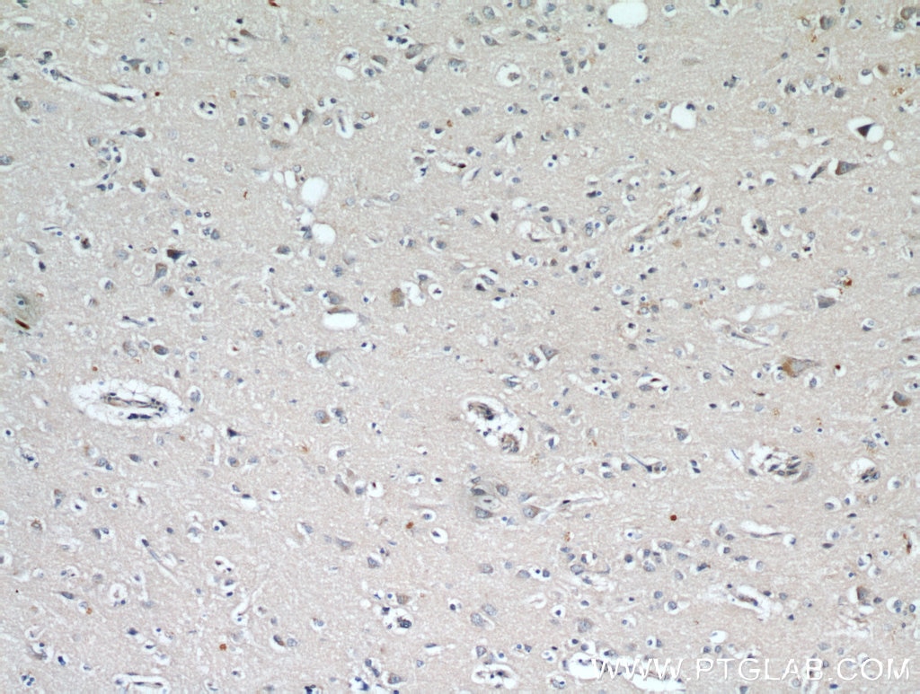 Immunohistochemistry (IHC) staining of human brain tissue using RYR2 Polyclonal antibody (19765-1-AP)
