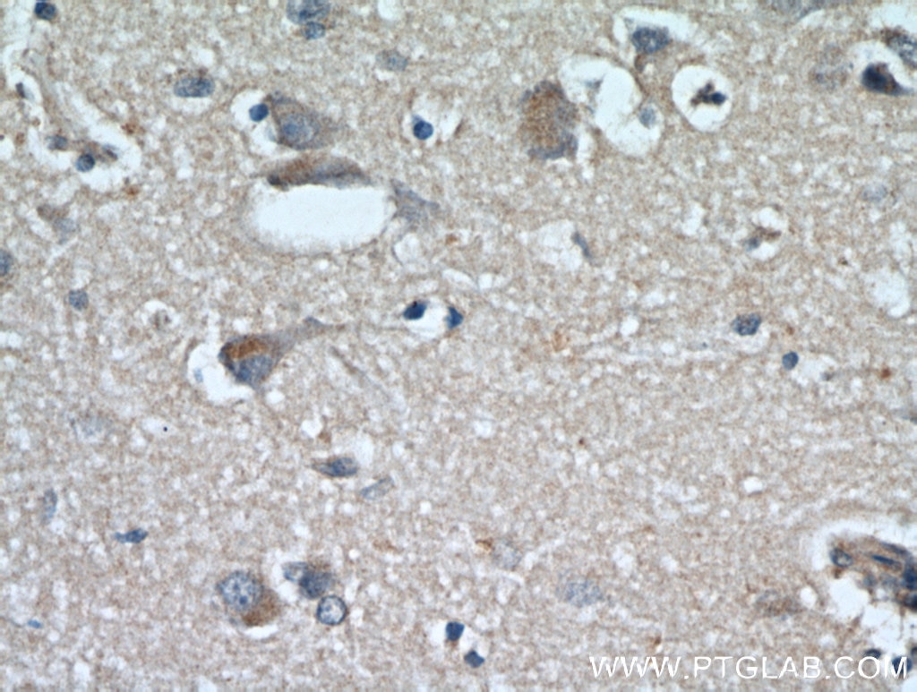 Immunohistochemistry (IHC) staining of human brain tissue using RYR2 Polyclonal antibody (19765-1-AP)