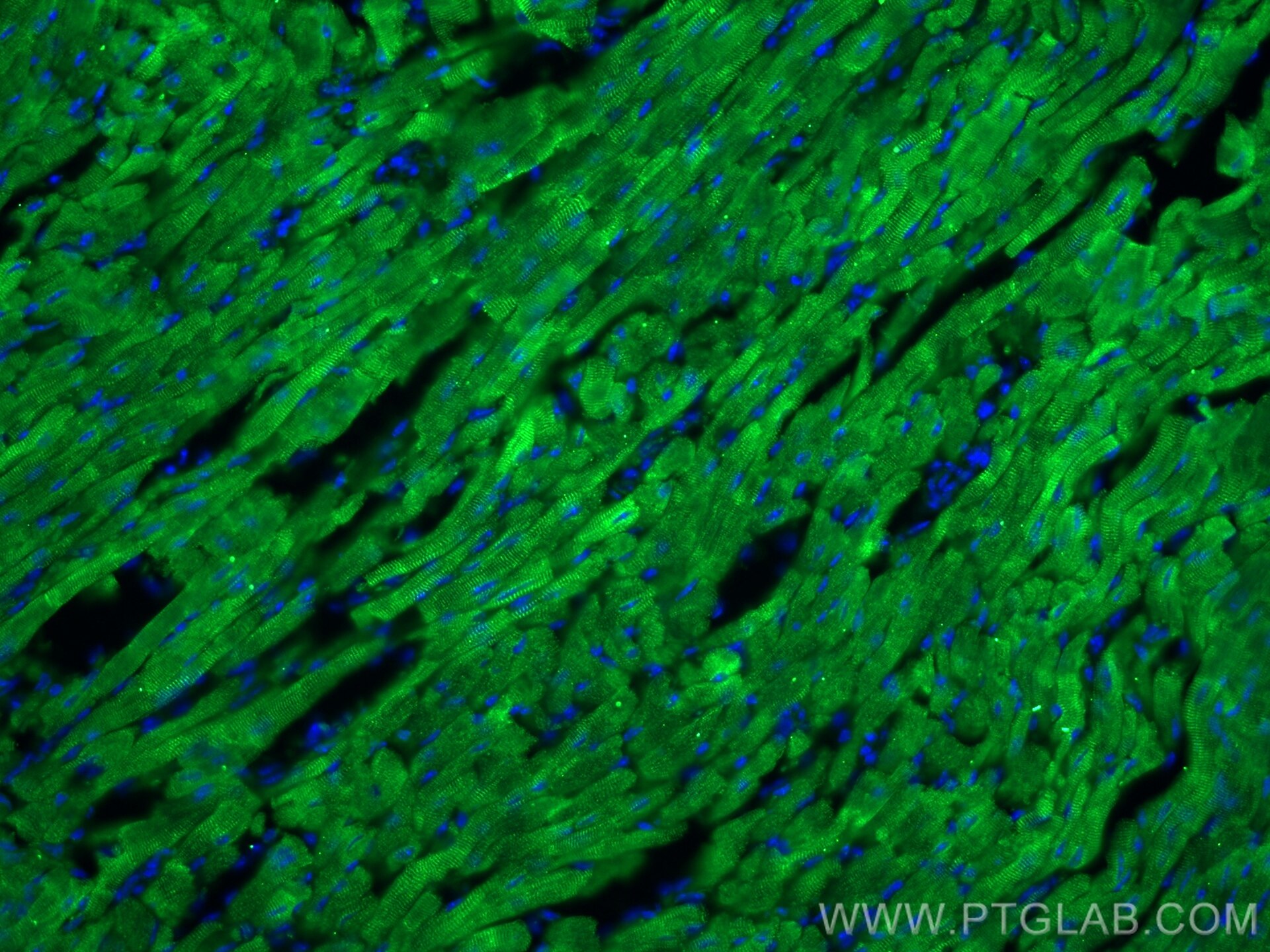 IF Staining of mouse heart using 27587-1-AP