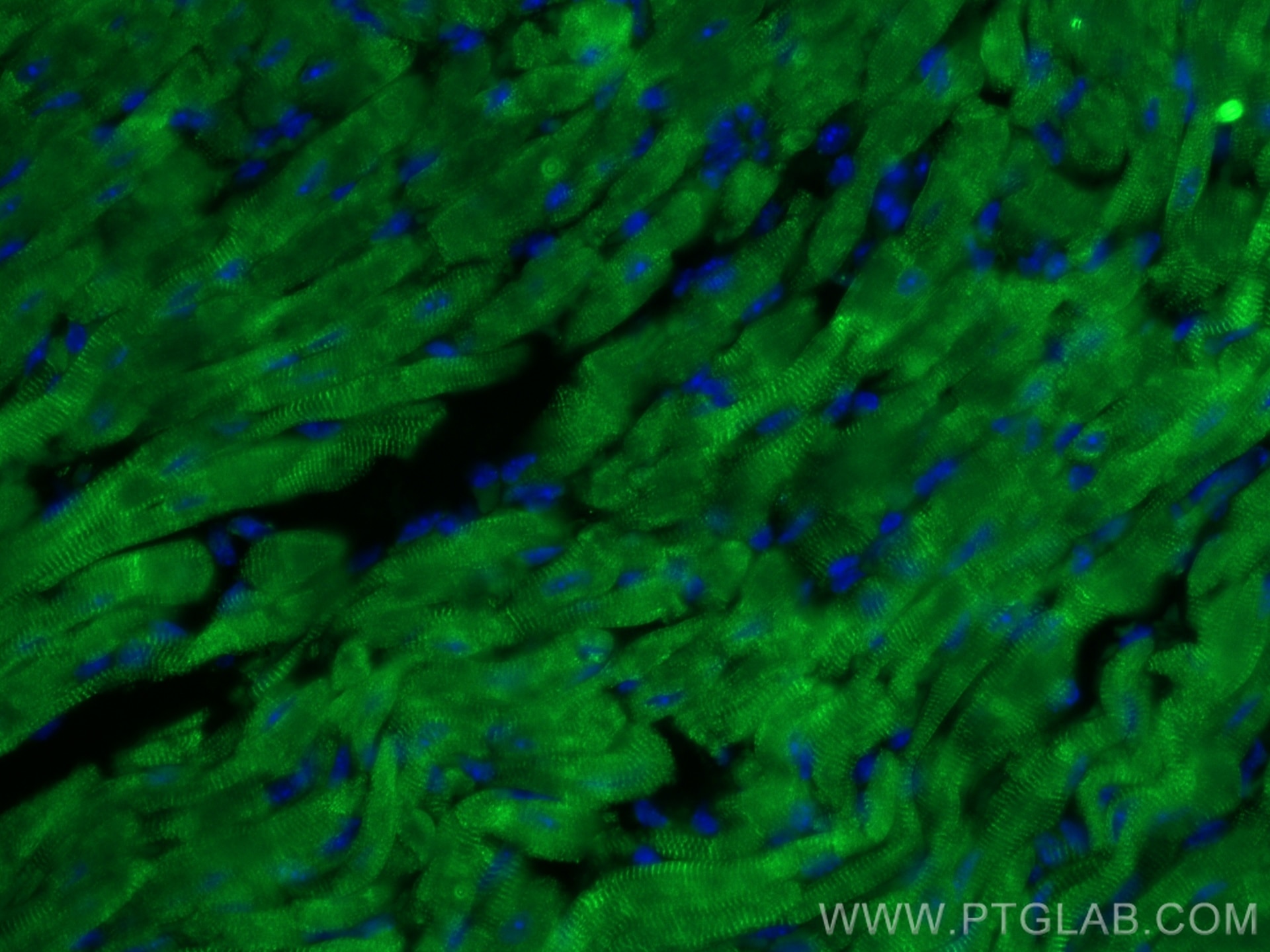 Immunofluorescence (IF) / fluorescent staining of mouse heart tissue using RYR2 Polyclonal antibody (27587-1-AP)
