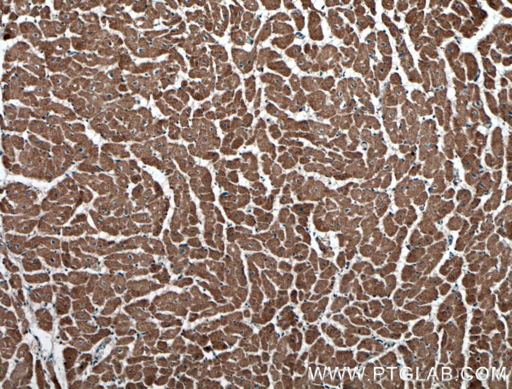 Immunohistochemistry (IHC) staining of human heart tissue using RYR2 Polyclonal antibody (27587-1-AP)