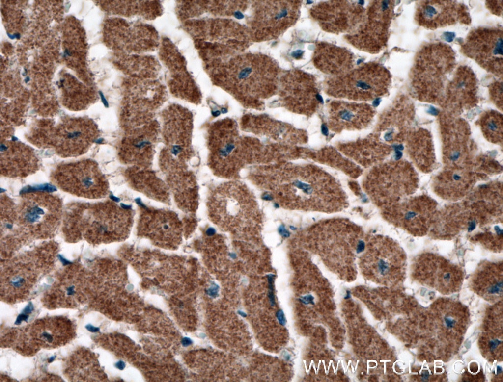 Immunohistochemistry (IHC) staining of human heart tissue using RYR2 Polyclonal antibody (27587-1-AP)