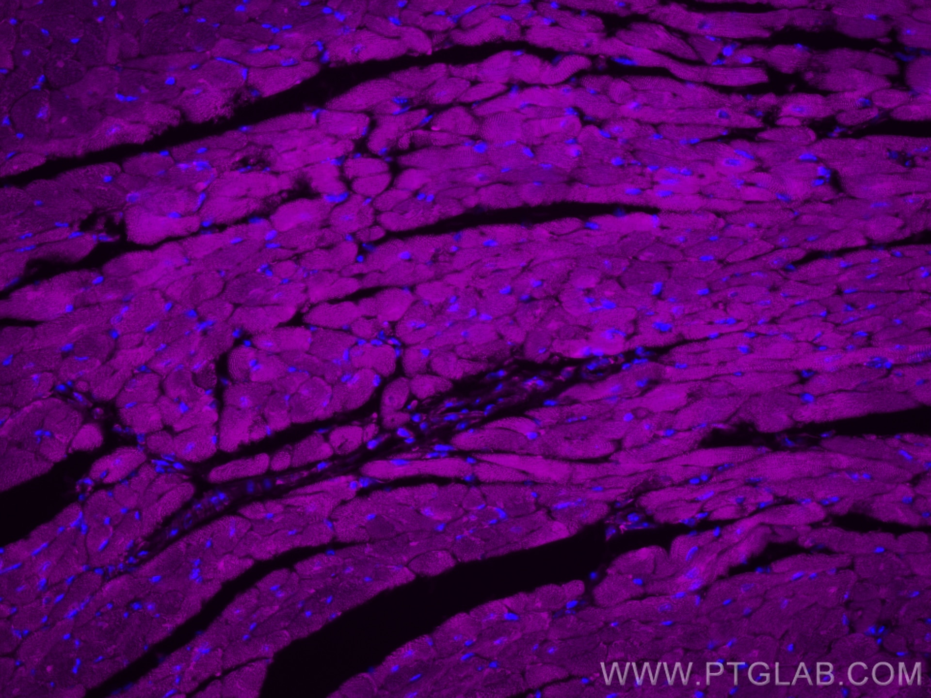 Immunofluorescence (IF) / fluorescent staining of mouse heart tissue using CoraLite® Plus 647-conjugated RYR2 Polyclonal anti (CL647-27587)