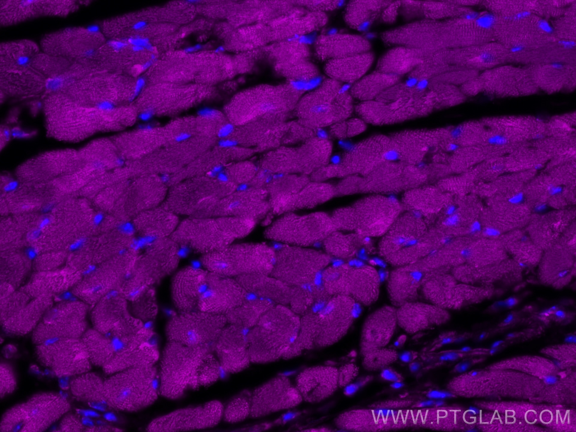 IF Staining of mouse heart using CL647-27587