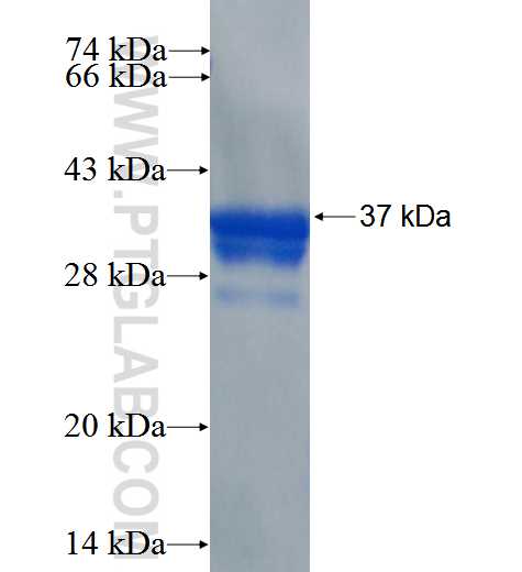 RYR2 fusion protein Ag26296 SDS-PAGE