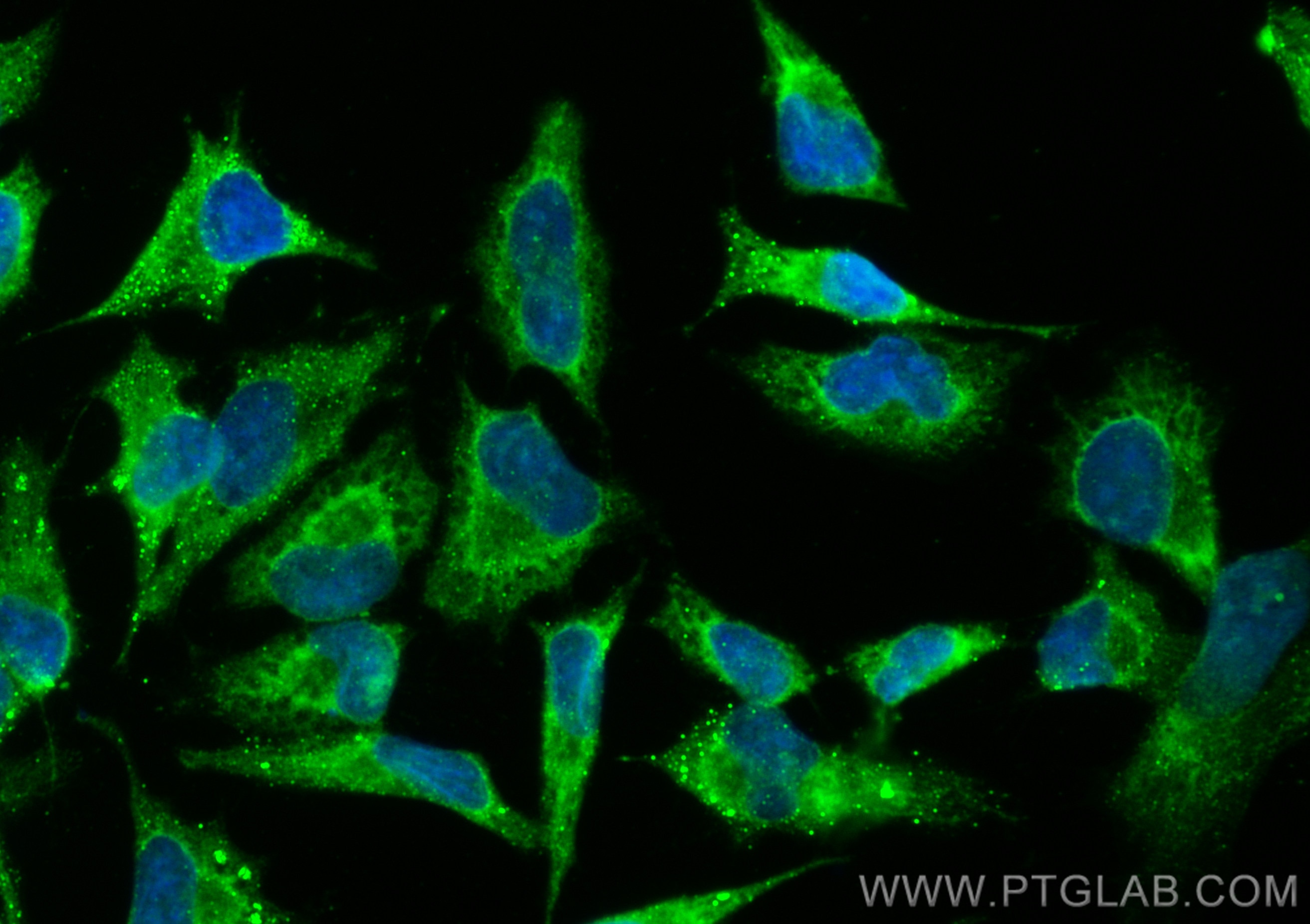 Immunofluorescence (IF) / fluorescent staining of HeLa cells using CoraLite® Plus 488-conjugated Rac1 Polyclonal anti (CL488-24072)