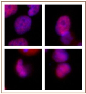 Rad21 antibody (mAb) tested by immunofluorescence. Formaldehyde fixed HeLa cells stained with Rad21 antibody at a 0.5 ug/ml dilution.