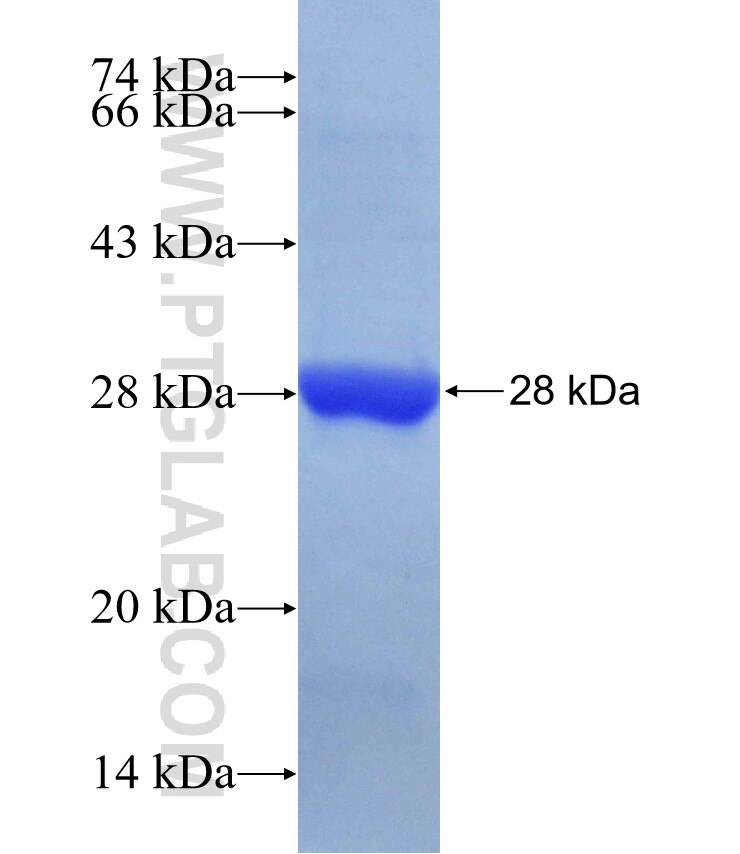 Rad51D fusion protein Ag27068 SDS-PAGE