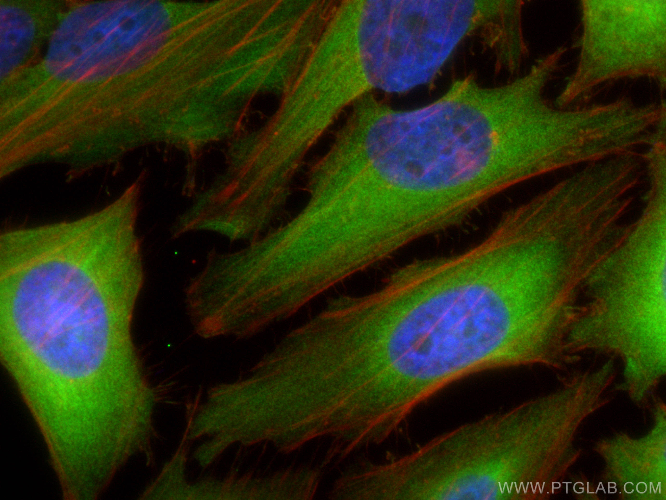 Immunofluorescence (IF) / fluorescent staining of HeLa cells using RanBP1 Polyclonal antibody (27804-1-AP)