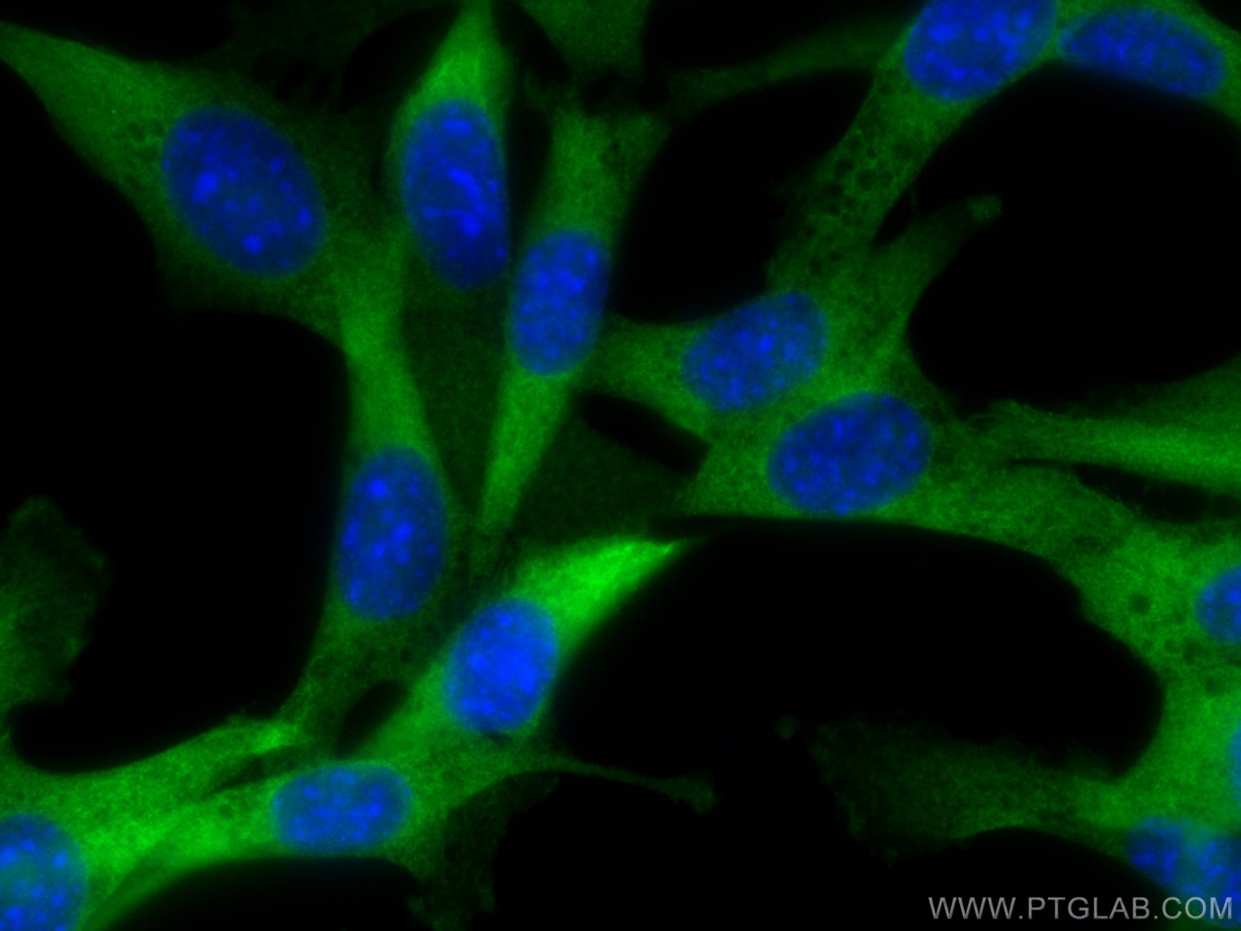 Immunofluorescence (IF) / fluorescent staining of NIH/3T3 cells using RanBP1 Polyclonal antibody (27804-1-AP)
